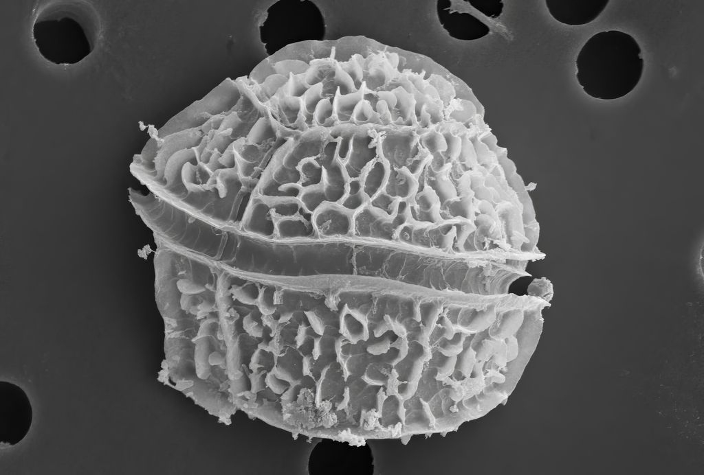 Dinoflagellate algae under the scanning electron microscope.